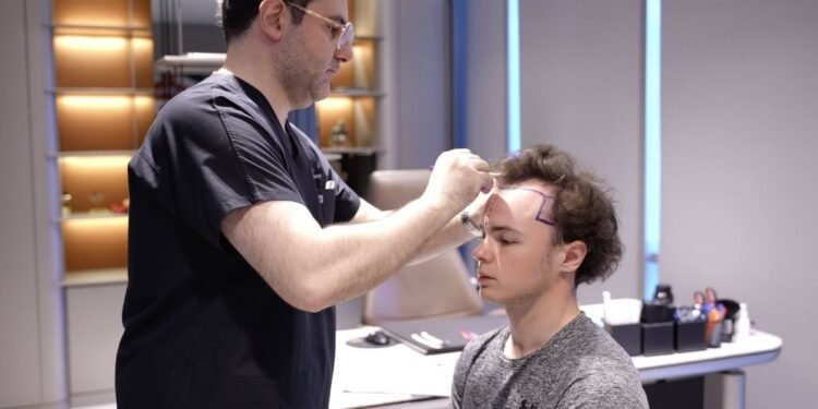 hair transplant turkey